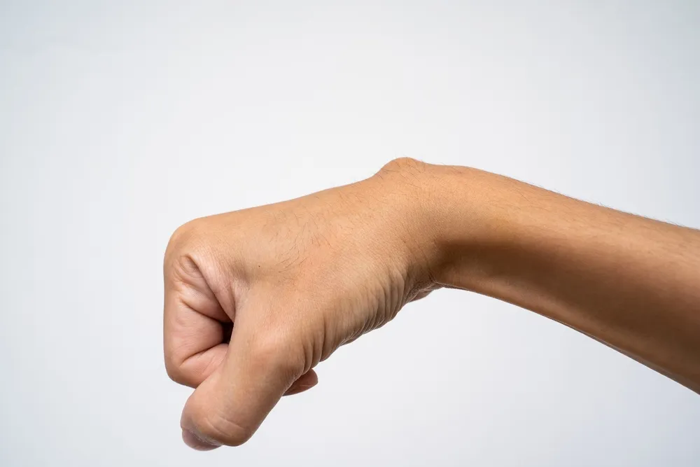 Ganglion